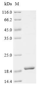 Loligo pealeii Voltage-dependent anion-selective channel protein, partial Recombinant Protein, Doryteuthis pealeii (Longfin inshore squid) (Loligo pealeii), E.coli, N-terminal 6xHis-KSI-tagged, 18.3 kDa, purity >≥ 90% as determined by SDS-PAGE.