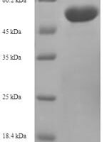 Mouse 2-oxoglutaRate dehydrogenase, mitochondrial (Ogdh), partial Recombinant Protein - BioCrest Sci