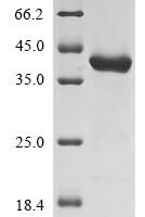 Mouse Enoyl-CoA hydratase, mitochondrial (Echs1) (C225S) Recombinant Protein - BioCrest Sci