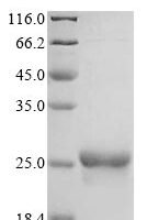 Saccharomyces cerevisiae Glutathione peroxidase-like peroxiredoxin 2 (GPX2) Recombinant Protein, N-His - BioCrest Sci