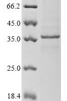 Mus musculus Receptor-type tyrosine-protein phosphatase S (Ptprs), partial Recombinant Protein - BioCrest Sci