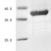 Human Non-receptor tyrosine-protein kinase TYK2 (TYK2), partial Recombinant Protein, N-His - BioCrest Sci