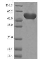 Agrobacterium sp.3-phosphoshikimate 1-carboxyvinyltransferase (aroA) Recombinant Protein - BioCrest Sci