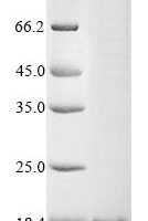 Human Oxytocin-neurophysin 1 (OXT), partial Recombinant Protein, N-10His/C-Myc - BioCrest Sci