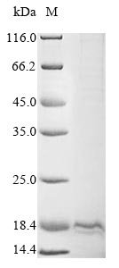 Human Oxytocin-neurophysin 1 (OXT), partial Recombinant Protein, N-10His/C-Myc, Homo sapiens (Human), Mammalian cell, N-terminal 10xHis-tagged and C-terminal Myc-tagged, 14.6 kDa, purity >≥ 85% as determined by SDS-PAGE.