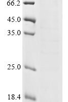 Human Mammaglobin-B (SCGB2A1) Recombinant Protein - BioCrest Sci