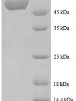 Human Spermidine synthase (SRM), partial Recombinant Protein - BioCrest Sci