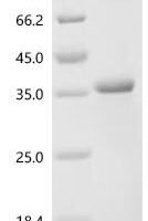 Human Serine/threonine-protein kinase Nek9 (NEK9), partial Recombinant Protein - BioCrest Sci