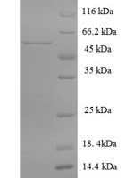 Rat Multiple inositol polyphosphate phosphatase 1 (Minpp1) Recombinant Protein, N-His, aa 31–481, E.coli - BioCrest Sci
