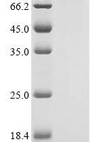 Human UDP-N-acetylglucosamine--peptide N-acetylglucosaminyltransferase 110 kDa subunit (OGT ) Recombinant Protein - BioCrest Sci