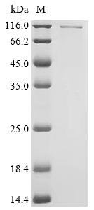 Human UDP-N-acetylglucosamine--peptide N-acetylglucosaminyltransferase 110 kDa subunit (OGT ) Recombinant Protein, Homo sapiens (Human), Baculovirus, C-terminal 6xHis-tagged, 121.8 kDa, purity >≥ 85% as determined by SDS-PAGE.