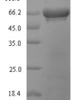 Glycine max Ribulose bisphosphate carboxylase large chain (rbcL) Recombinant Protein - BioCrest Sci