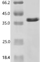 Mouse Alpha/beta-tubulin-N-acetyltransferase 9 (Nat9) Recombinant Protein - BioCrest Sci