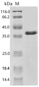 Mouse Alpha/beta-tubulin-N-acetyltransferase 9 (Nat9) Recombinant Protein, E.coli, C-terminal 6xHis-tagged, 34.6 kDa, purity >≥ 90% as determined by SDS-PAGE.