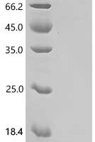 Human TP53&S100P Heterodimer Protein Recombinant Protein - BioCrest Sci