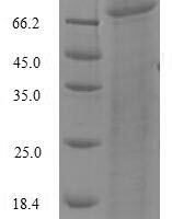 Synechococcus sp. Deoxyribodipyrimidine photo-lyase (phr) Recombinant Protein - BioCrest Sci