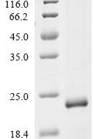 Acyrthosiphon pisum Odorant-binding protein3 (obp3) Recombinant Protein - BioCrest Sci