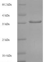 Human TATA box-binding protein-like protein 1 (TBPL1), partial Recombinant Protein - BioCrest Sci