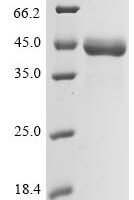 AKV murine leukemia virus Envelope glycoprotein (env), partial Recombinant Protein, N-10His/C-Myc - BioCrest Sci