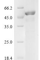 Human Ras-related protein Rab-35 (RAB35) Recombinant Protein - BioCrest Sci