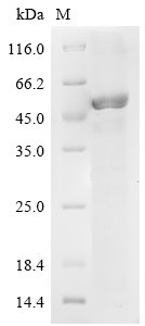 Human Ras-related protein Rab-35 (RAB35) Recombinant Protein, Homo sapiens (Human), E.coli, N-terminal 6xHis-GST-tagged, 54.6 kDa, purity >≥ 85% as determined by SDS-PAGE.