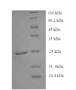 Human Histone deacetylase 9 (HDAC9), partial Recombinant Protein - BioCrest Sci