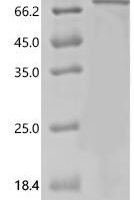 Human Metabotropic glutamate receptor 5 (GRM5), partial Recombinant Protein, N-His-SUMO - BioCrest Sci
