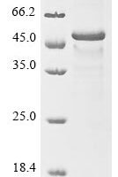 Human Cytokine receptor-like factor 1 (CRLF1) Recombinant Protein, N-10His/C-Myc, aa 38–422, E.coli - BioCrest Sci