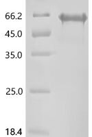Human Desmoglein-1 (DSG1), partial Recombinant Protein, N-10His/C-Twin-Strep - BioCrest Sci