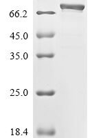 Severe acute respiratory syndrome coronavirus 2 Nucleoprotein (N), partial,Biotinylated Recombinant Protein - BioCrest Sci