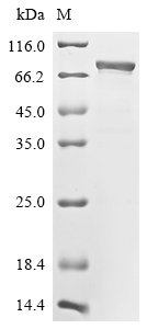 Severe acute respiratory syndrome coronavirus 2 Nucleoprotein (N), partial,Biotinylated Recombinant Protein, Severe acute respiratory syndrome coronavirus 2 (2019-nCoV) (SARS-CoV-2), E.coli, N-terminal MBP-tagged and C-terminal 6xHis-Avi-tagged, 73.3 kDa, purity >≥ 85% as determined by SDS-PAGE.