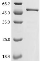 Human Endophilin-A1 (SH3GL2) Recombinant Protein - BioCrest Sci