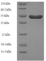Human Kit ligand (KITLG), partial Recombinant Protein, N-GST - BioCrest Sci