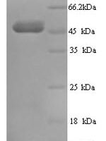 Human Transcobalamin-1 (TCN1) Recombinant Protein - BioCrest Sci