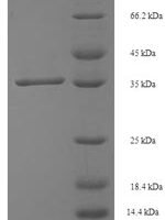 Human Single-strand selective monofunctional uracil DNA glycosylase (SMUG1) Recombinant Protein - BioCrest Sci