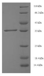 Human Single-strand selective monofunctional uracil DNA glycosylase (SMUG1) Recombinant Protein, Homo sapiens (Human), E.coli, N-terminal 6xHis-SUMO-tagged, 35.6 kDa, purity >≥ 90% as determined by SDS-PAGE.