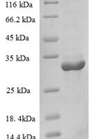 Human Cellular nucleic acid-binding protein (CNBP) Recombinant Protein - BioCrest Sci