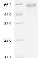 Human E3 ubiquitin-protein ligase TRIM11 (TRIM11) Recombinant Protein, N-His - BioCrest Sci