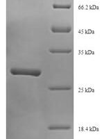 Trichosanthes kirilowii Ribosome-inactivating protein alpha-trichosanthin Recombinant Protein, N-His - BioCrest Sci