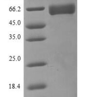 Human Basigin (BSG), partial Recombinant Protein, C-hFc1 - BioCrest Sci