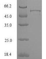 Human Heterogeneous nuclear ribonucleoproteins A2/B1 (HNRNPA2B1) Recombinant Protein, N-GST - BioCrest Sci