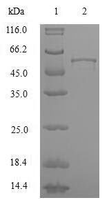Human Heterogeneous nuclear ribonucleoproteins A2/B1 (HNRNPA2B1) Recombinant Protein, N-GST, Homo sapiens (Human), E.coli, N-terminal GST-tagged, 55.4 kDa, purity >≥ 90% as determined by SDS-PAGE.