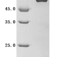 Human Atrial natriuretic peptide receptor 3 (NPR3), Partial Recombinant Protein - BioCrest Sci
