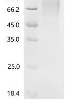 Prunus persica Uncharacterized protein Recombinant Protein, C-His, aa 1–305, Yeast - BioCrest Sci