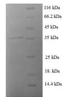 Human C-C motif chemokine 8 (CCL8) Recombinant Protein, N-GST - BioCrest Sci