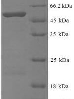 Cryptomeria japonica Pectate lyase 1 Recombinant Protein - BioCrest Sci