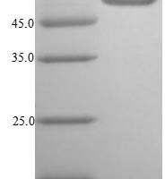 Vibrio vulnificus Cytolysin (vvhA) Recombinant Protein - BioCrest Sci
