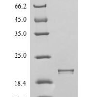 Human Integrin alpha-V (ITGAV), partial Recombinant Protein - BioCrest Sci