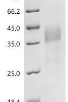 Mouse Macrophage colony-stimulating factor 1 (Csf1), partial Recombinant Protein, N-His, aa 33–262, Yeast - BioCrest Sci