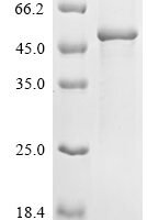 Human Keratin, type I cuticular Ha1 (KRT31) Recombinant Protein - BioCrest Sci